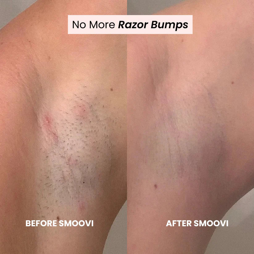 Smoovi 2.0 Bikini Shaver